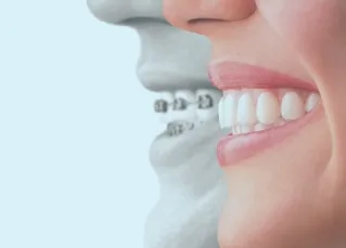 矯正治療